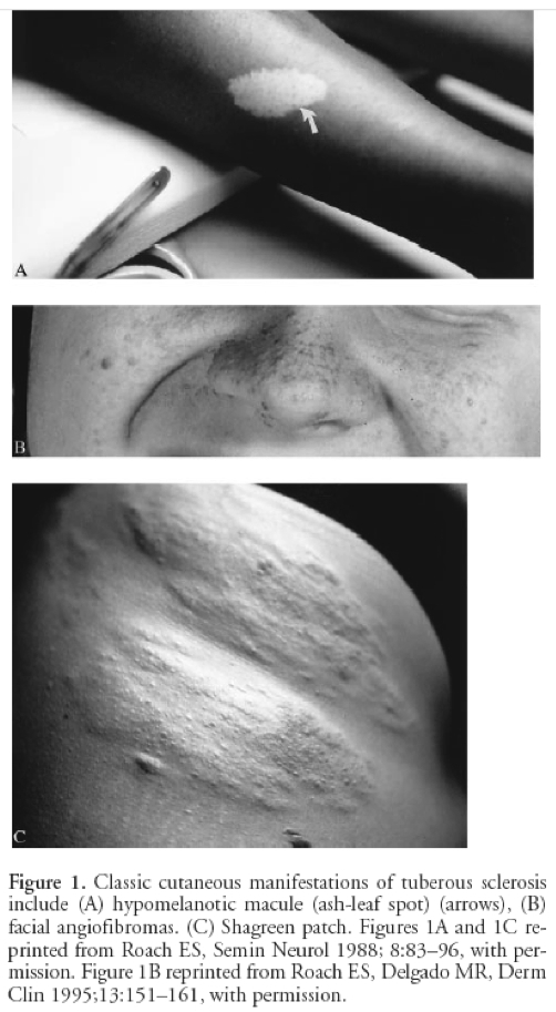 skin1