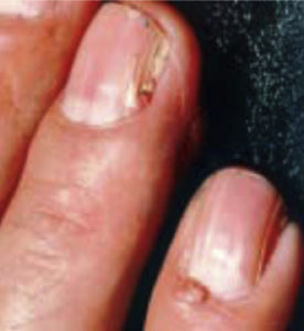 skin3
