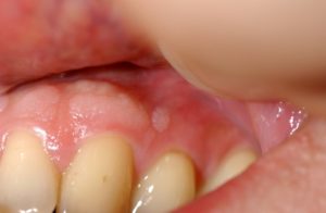 teeth4